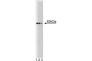 Western Blotting (WB) image for anti-Nucleoporin 62kDa (NUP62) (AA 24-178) antibody (ABIN968005)