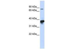Image no. 1 for anti-LON Peptidase N-terminal Domain and Ring Finger 2 (LONRF2) (AA 576-625) antibody (ABIN6740829) (LONRF2 anticorps  (AA 576-625))