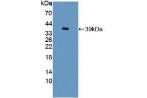 Western blot analysis of recombinant Rat TFF3. (TFF3 anticorps  (AA 23-81))