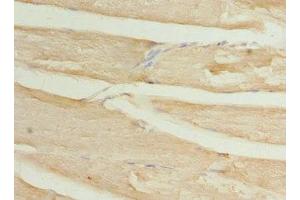 Immunohistochemistry of paraffin-embedded human skeletal muscle tissue using ABIN7175750 at dilution of 1:100 (WDR38 anticorps  (AA 1-314))
