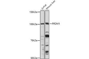Western blot analysis of extracts of various cell lines, using (ABIN6128500, ABIN6146126, ABIN6146127 and ABIN6219111) at 1:1000 dilution. (PRDM1 anticorps  (AA 1-240))