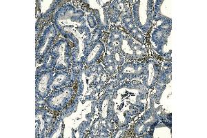 IHC analysis of F2R using anti-F2R antibody (ABIN7599952). (PAR1 anticorps  (AA 130-425))