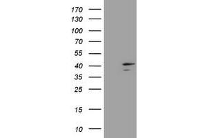 Image no. 6 for anti-Decapping Enzyme, Scavenger (DCPS) antibody (ABIN1497781)
