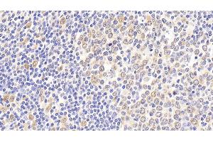 Detection of HSPA8 in Human Tonsil Tissue using Polyclonal Antibody to Heat Shock 70 kDa Protein 8 (HSPA8)