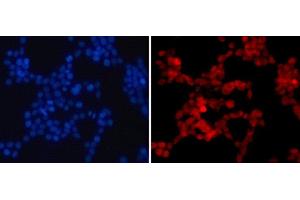 Immunofluorescence analysis of 293T cells using Asymmetric DiMethyl-Histone H4-R3 Polyclonal Antibody (Histone H4 anticorps  (H4R3me2a))