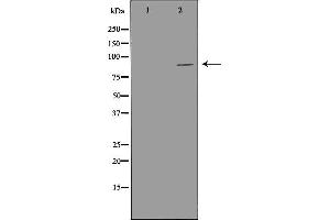 Western blot analysis of LoVo cell lysate, using PIBF1 Antibody. (PIBF1 anticorps  (C-Term))