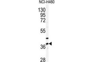 Western Blotting (WB) image for anti-Pantothenate Kinase 3 (PANK3) antibody (ABIN3003020) (PANK3 anticorps)