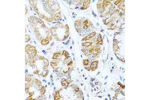 Immunohistochemistry of paraffin-embedded human stomach using INHBC antibody at dilution of 1:100 (40x lens). (INHBC anticorps)