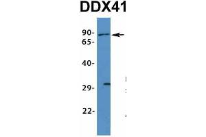 Host:  Rabbit  Target Name:  DDX41  Sample Type:  Human Fetal Muscle  Antibody Dilution:  1. (DDX41 anticorps  (N-Term))