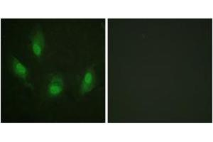 Immunofluorescence analysis of HeLa cells, using p53 (Ab-392) Antibody. (p53 anticorps  (AA 344-393))