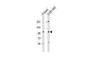 All lanes : Anti-MBD6 Antibody (C-term) at 1:1000 dilution Lane 1: human brain lysate Lane 2: U-251 MG whole cell lysate Lysates/proteins at 20 μg per lane. (MBD6 anticorps  (C-Term))
