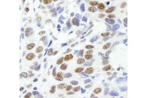 Immunohistochemistry (IHC) image for anti-Ewing Sarcoma Breakpoint Region 1 (EWSR1) (AA 100-150) antibody (ABIN7448557) (EWSR1 anticorps  (AA 100-150))