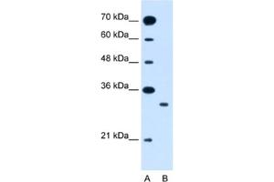 Western Blotting (WB) image for anti-Solute Carrier Family 25 (Mitochondrial Carrier: Glutamate), Member 22 (SLC25A22) antibody (ABIN2462766) (SLC25A22 anticorps)