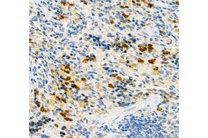 Immunohistochemistry of paraffin embedded rat spleen using CEACAM1 (ABIN7073315) at dilution of 1: 650 (400x lens)