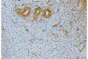 ABIN6276601 at 1/100 staining Human uterus tissue by IHC-P. (FGF10 anticorps  (C-Term))