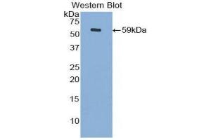 Western Blotting (WB) image for anti-Cadherin 4 (CDH4) (AA 667-916) antibody (ABIN1860421) (Cadherin 4 anticorps  (AA 667-916))