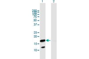 Western Blot analysis of VNN3 expression in transfected 293T cell line by VNN3 MaxPab polyclonal antibody. (VNN3 anticorps  (AA 1-147))
