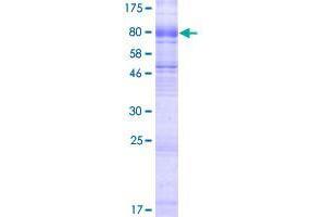 Image no. 1 for Solute Carrier Family 6 (Neutral Amino Acid Transporter), Member 19 (SLC6A19) (AA 1-634) protein (GST tag) (ABIN3013387)