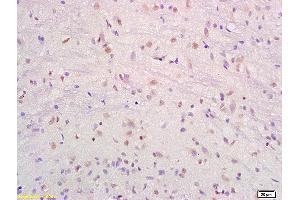 Formalin-fixed and paraffin embedded rat brain labeled with Anti-SRF/SAP2/MCM1 Polyclonal Antibody, Unconjugated (ABIN686017) at 1:200 followed by conjugation to the secondary antibody and DAB staining.