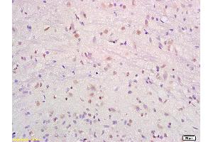 Formalin-fixed and paraffin embedded rat brain labeled with Anti-SRF/SAP2/MCM1 Polyclonal Antibody, Unconjugated (ABIN686017) at 1:200 followed by conjugation to the secondary antibody and DAB staining. (SRF anticorps  (AA 101-250))