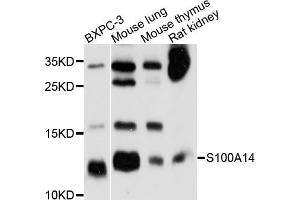 Western blot analysis of extracts of various cell lines, using S100A14 antibody (ABIN5998736) at 1/1000 dilution.