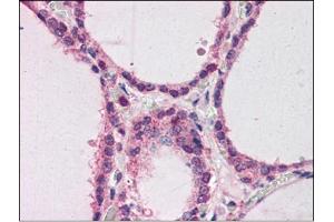 Human Thyroid (formalin-fixed, paraffin-embedded) stained with HNF4Aat 2 µg/ml followed by biotinylated anti-goat IgG secondary antibody, alkaline phosphatase-streptavidin and chromogen. (HNF4A anticorps  (N-Term))