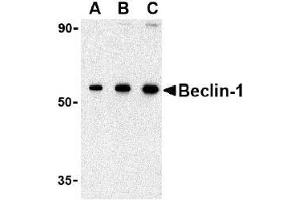 AP20054PU-N Beclin-1 antibody staining of 293 cell lysate by Western Blotting at (A) 0.