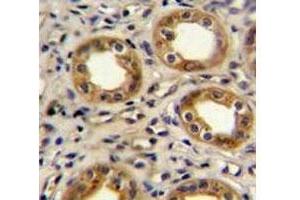 CXCR3 antibody immunohistochemistry analysis in formalin fixed and paraffin embedded human kidney tissue.