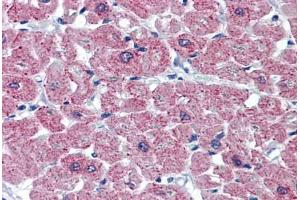 Human Heart: Formalin-Fixed, Paraffin-Embedded (FFPE)