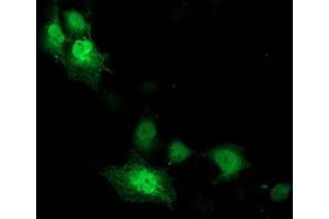 Immunofluorescence (IF) image for anti-Cyclin-Dependent Kinase 2 (CDK2) antibody (ABIN1497394) (CDK2 anticorps)