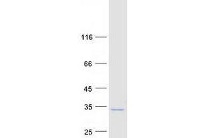 Validation with Western Blot