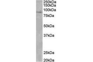 AP31953PU-N SETDB2 antibody staining of Human Heart lysate at 0.