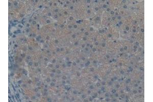 Used in DAB staining on fromalin fixed paraffin- embedded liver cancer tissue