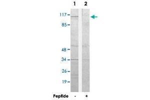 Western blot analysis of extracts from 293 cells, using CDCA2 polyclonal antibody . (CDCA2 anticorps  (C-Term))