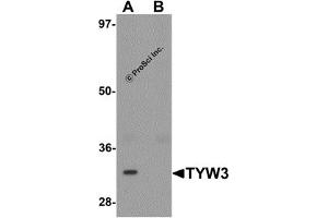 Western Blotting (WB) image for anti-tRNA-YW Synthesizing Protein 3 Homolog (TYW3) (Middle Region) antibody (ABIN1031152) (TYW3 anticorps  (Middle Region))