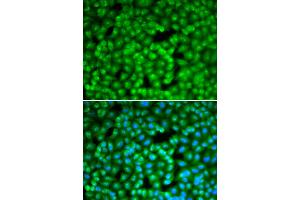 Immunofluorescence analysis of A549 cells using FBL antibody (ABIN6292110). (Fibrillarin anticorps)