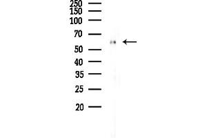 Western blot analysis of lysates from Rat liver, using ALDH4 Antibody at 1/1000 dilution.