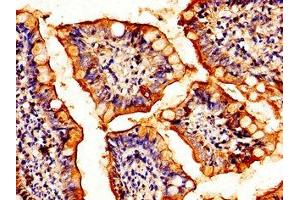 Immunohistochemistry of paraffin-embedded human small intestine tissue using ABIN7154893 at dilution of 1:100 (HSF2 anticorps  (AA 79-173))