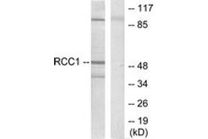 Western blot analysis of extracts from HepG2 cells, using Retinoic Acid Receptor beta Antibody. (Retinoic Acid Receptor beta anticorps  (AA 331-380))