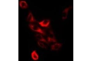 Immunofluorescent analysis of TC-PTP staining in Jurkat cells.