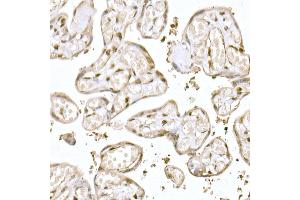 Immunohistochemistry of paraffin-embedded human colon using MUC2 Rabbit pAb (ABIN7268690) at dilution of 1:300 (40x lens).
