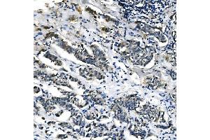 IHC analysis of PCK2 using anti-PCK2 antibody (ABIN7599509). (PEPCK anticorps  (AA 1-640))