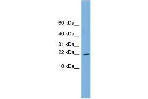 Human THP-1; WB Suggested Anti-RPS13 Antibody Titration: 0. (RPS13 anticorps  (Middle Region))
