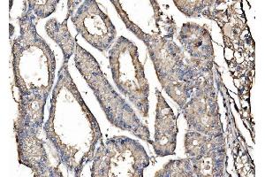 IHC analysis of Kinectin 1/KTN1 using anti-Kinectin 1/KTN1 antibody (ABIN7601096). (KTN1 anticorps  (AA 283-827))