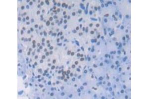 IHC-P analysis of Human Tissue, with DAB staining. (TRADD anticorps  (AA 61-297))