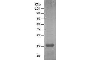 Western Blotting (WB) image for Interleukin 1, beta (IL1B) (AA 116-268) protein (His tag) (ABIN7123532)