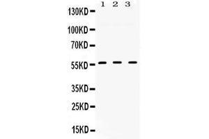 Western blot analysis of TGFBR1 expression in rat cardiac muscle extract ( Lane 1), mouse liver extract ( Lane 2) and HELA whole cell lysates ( Lane 3).