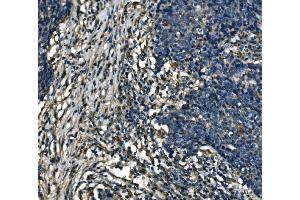 IHC analysis of ATP6V1A using anti-ATP6V1A antibody (ABIN7599916).