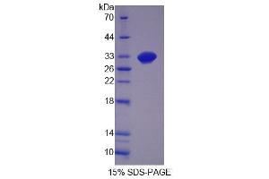 SDS-PAGE analysis of Mouse GDF11 Protein. (GDF11 Protéine)