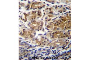 Immunohistochemistry (IHC) image for anti-Pyruvate Dehydrogenase Phosphatase Regulatory Subunit (PDPR) antibody (ABIN2996488) (PDPR anticorps)